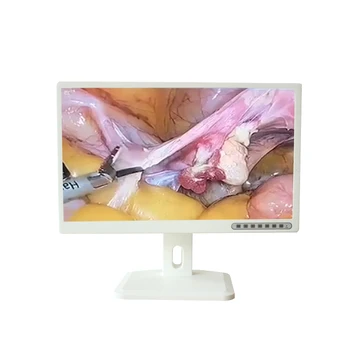 Медицински преносим 24-инчов монитор Бял LCD ендоскоп монитор