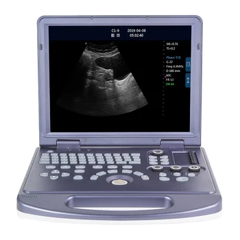 преносим ултразвуков скенер PC платформа Full-цифрова ултразвукова диагностична система ултразвукова машина